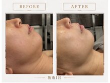 モミン(MOMI.N)の雰囲気（小顔になりたい！マシンで脂肪分解しコルギで引き締め！二重顎◎）