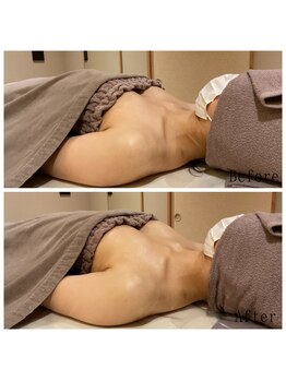 オクノマ(OKUNOMA)/【お客様BeforeAfter】