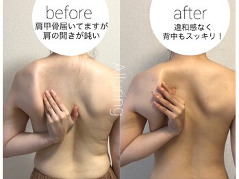アルアリング 春日原(Alluring)/☆バストの為の背中筋膜リリース
