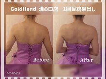 ゴールドハンド 溝の口店(Gold Hand)/ブライダル痩身1回結果出し
