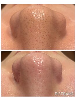 ジュエッテ(jouete)/水光アクアピール