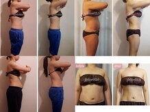 筋トレや減量で改善しない下腹は腸揉み☆9割以上が便秘改善☆