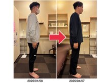 はやしだ鍼灸整骨院/3ヶ月でウエスト-10cm以上！