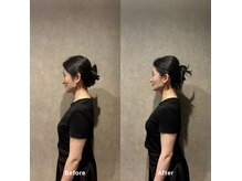 ビアライン オオサカ(Be align Osaka)の雰囲気（【小顔メニュー】肩、首から調整）