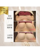 ロココ 町田店(Rococo)/15回でこの変化！