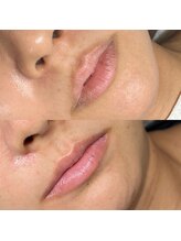 シーズ(C'ies)/ローマピンク