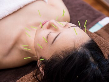 一丁目治療院の写真/痛み最小限！髪の毛のように細い鍼で初めての方にも◎慢性的な頭痛・冷え・女性特有のお悩み改善に♪