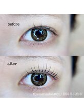 ロイ(ROI)/まつげパーマ　ビフォーアフター