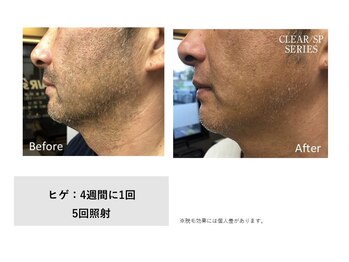 エムエスアイ(MSI)/