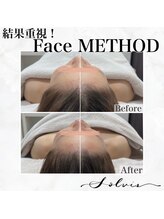 ソルヴィス(SOLVIS)/