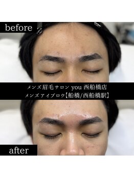 ユー 西船橋店(you)/ビフォーアフター写真