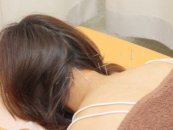 かねこ鍼灸接骨院の写真/肩・首のこりやつらさに。なかなか改善しないお悩みをプロのほぐしや鍼灸施術でケア☆