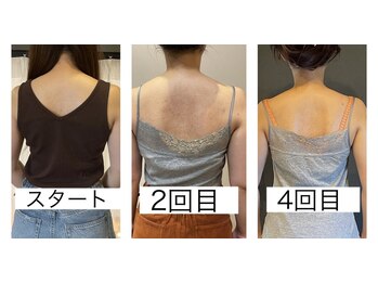 エスデザイン(es design)/デコルテマッサージ/肩甲骨