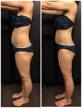 アルコイリス(Arco iris)/むくみが取れただけ！60分の変化