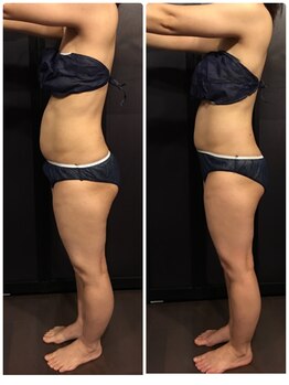 アルコイリス(Arco iris)/むくみが取れただけ!60分の変化