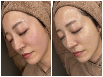 ムゥ(Mwoo)/ララピール/ララピール西宮