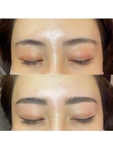 セレーノ 横浜店(seReno)/左右差のお悩みもお任せください