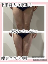 サロンシャイン(Salon Shine)/痩身エステ30代女性1回
