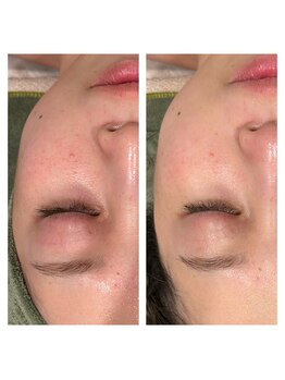 アンジール(ANJIR)/エンビロンフェイシャル