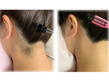 ブリリアンス(BRILLIANCE)/