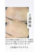 ソリッジ肌管理室/速攻毛穴ケア