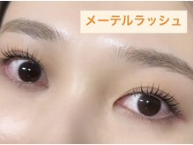 フロラ(Flora)/◇メーテルラッシュ