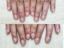 グラシナ なんば店/深爪/自爪育成/フィルイン