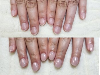 グラシナ なんば店/深爪/自爪育成/フィルイン