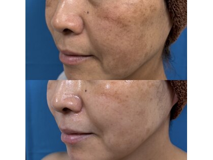 キレイになる路の写真