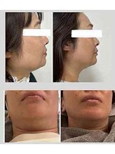 リタプレイス 琴似(LITAPLACE)/フェイスラインで印象は決まる！