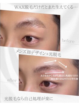 リノア(Linoa)/メンズ眉毛ビフォーアフター