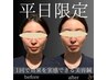 【◎月～木11～17時限定】口コミ必須！　小顔リフト美容鍼￥3,980→￥1,980_
