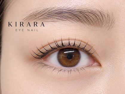 キララ(KIRARA)の写真