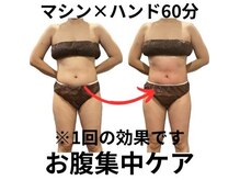 アラフェイスの雰囲気（1回の効果!!【速攻痩せ】激揉み＆脂肪燃焼インディバ(ラジオ波)）