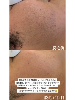 アレッド 大阪店(ared.)/毎日の手間を軽減