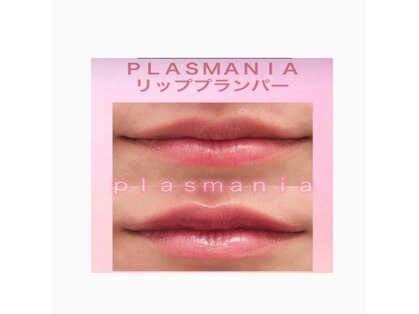 アクシア(Axia)の写真