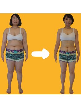 ホロニック ベルサンテ(Holonic Belle Sante)/メディセルハイブリッド