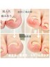 巻爪矯正2本　￥16,000　→　¥7,980