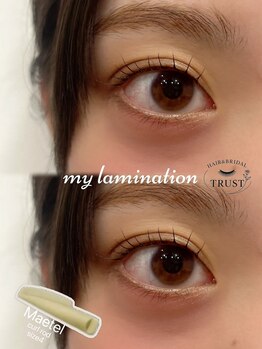 トラスト(Trust)/メーテルロッド使用♪