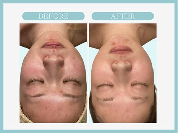 スリムライン 盛岡店(The Slim Line)/before→after