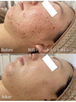 ラティア(Ratia)/