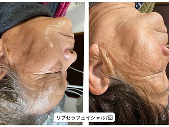 サロン アンネ(Anne)/リブセラフェイシャル