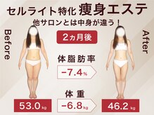 ラ パルレ 梅田本店の雰囲気（ブライダル/背中ケア/サイズダウン/ラインケア/体型ケア）