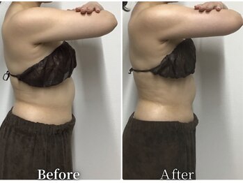 フィッツ 多治見店(fit's)/健康エステ