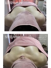 チュラ 大宮店(Chura)/【50代】バストアップ5回目@大宮