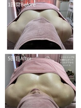 チュラ 大宮店(Chura)/【50代】バストアップ5回目@大宮