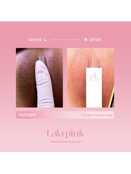 カルム(Calme)/Lalapink