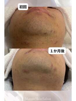 マウム(Maum)/髭剃りの時間減らしませんか？