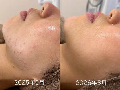 ミュー 岡崎店(mieux)の写真