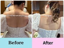 キッカ(kikka)の雰囲気(ドレス映えする後ろ姿へ、背中まで美しく◎)